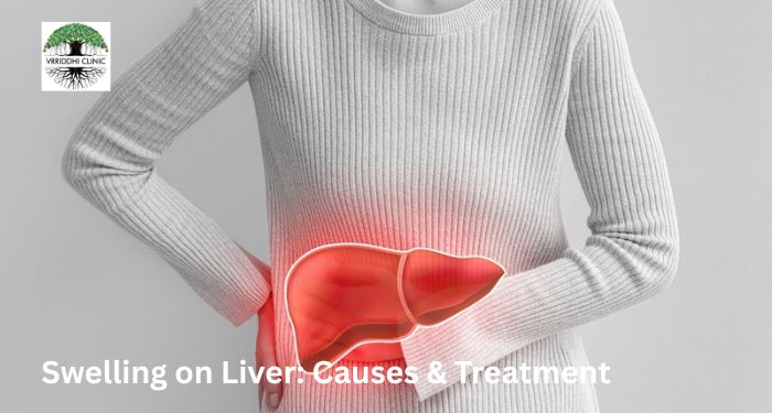 Experiencing liver swelling or hepatomegaly? Consult an expert Gastroenterologist in Pune for diagnosis, liver tests, and advanced treatment options.